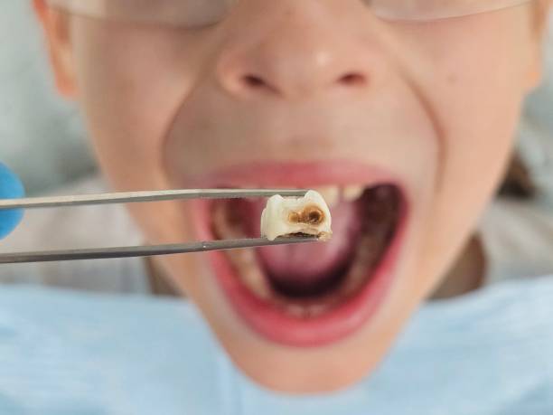 Best Emergency Pediatric Dental Care in Gonzales, TX